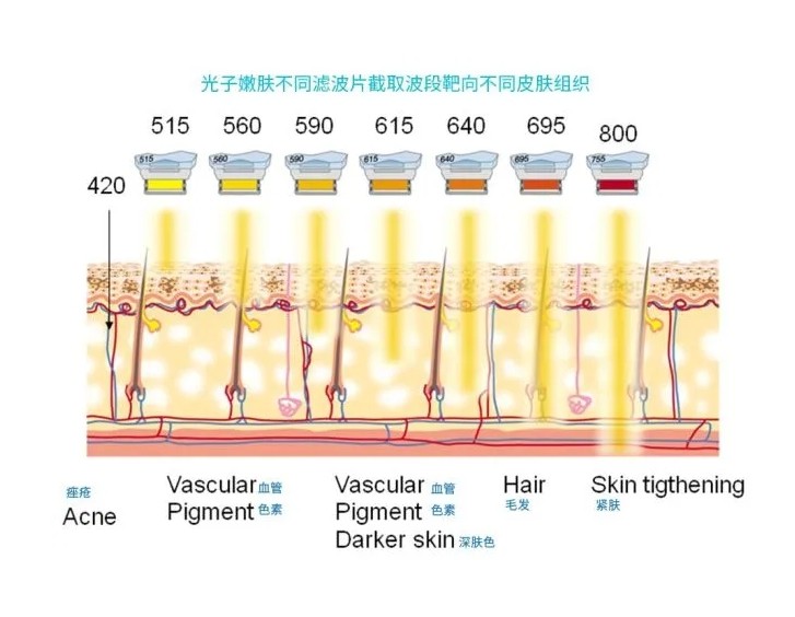 五大光子嫩膚技術(shù)（IPL、DPL、OPT、APT、BBL）及濾光片區(qū)別