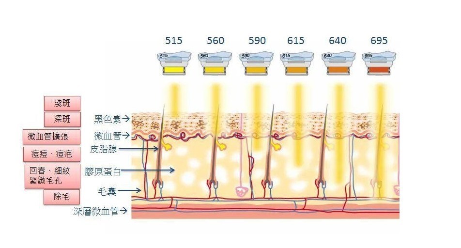 強脈沖濾光片光子美容波段滲透皮膚層